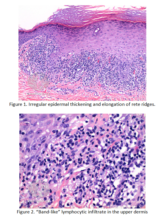 Case 12 - Q4 Explanation - Alberta Dermatology